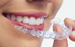 インビザライン